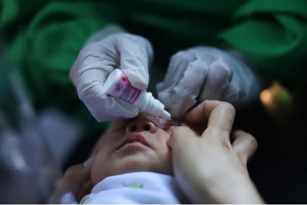 Kenali Rop (Retinopathy Of Prematurity), Penyakit Mata Akibat Lahir Prematur