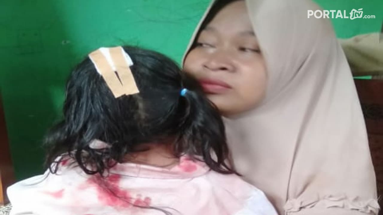Atap Ruangan Kelas Ambruk, Satu Siswa Terluka