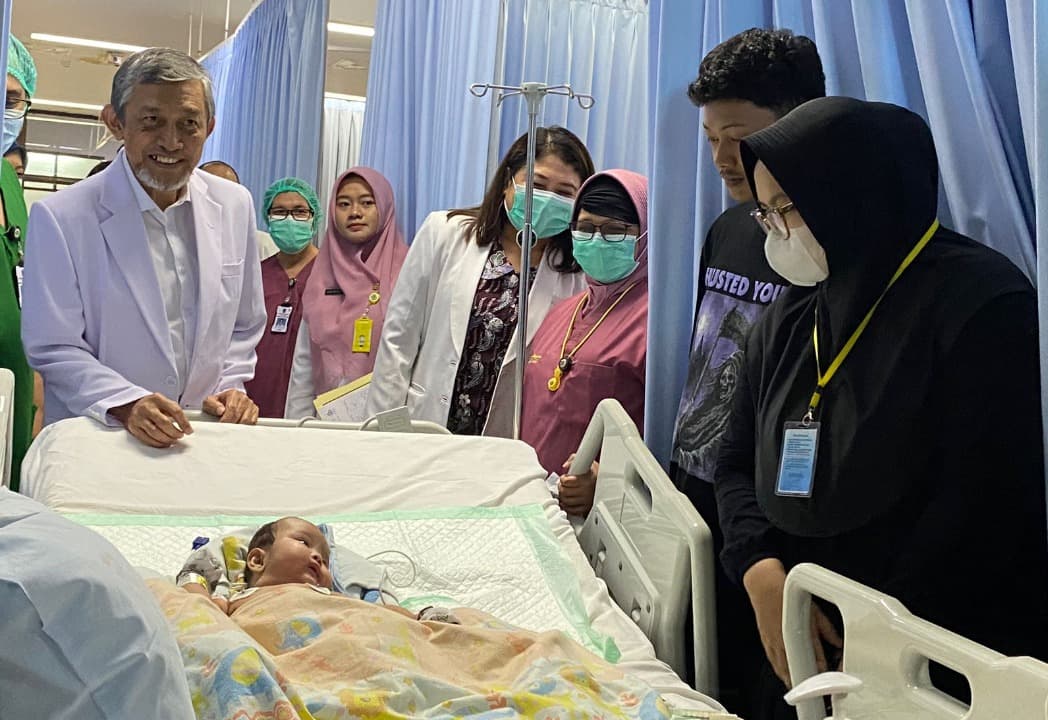 RSUD dr Soetomo Surabaya Pisahkan Bayi Kembar Siam Asal Tulungagung
