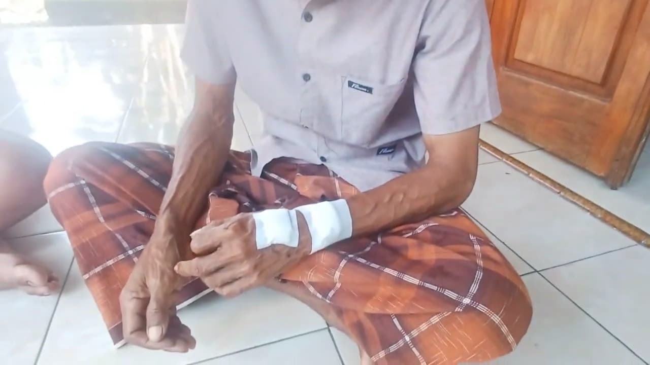 Ayah dan Anak Terkena Ledakan Proyektil  di Sekitar Kebakaran TRUK TNI AD
