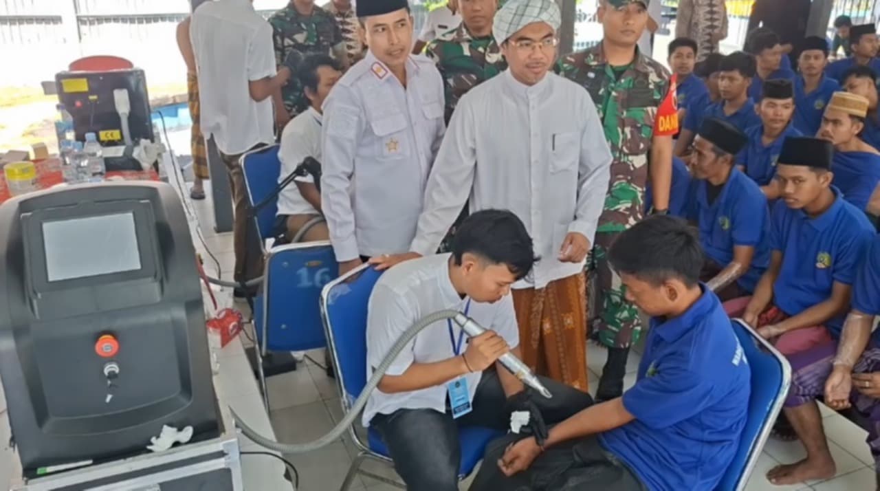 Antusias, Warga Binaan Rutan Sampang Jalani Penghapusan Tato