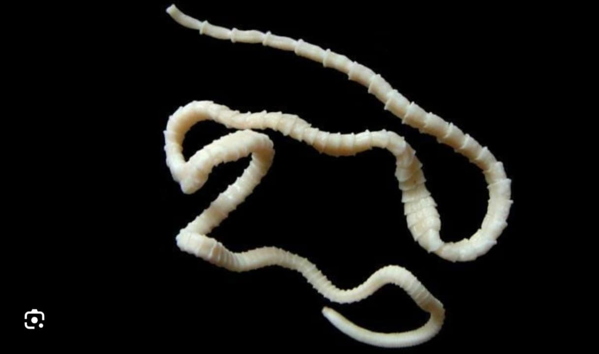 Bahayakah Infeksi Cacing Pita?