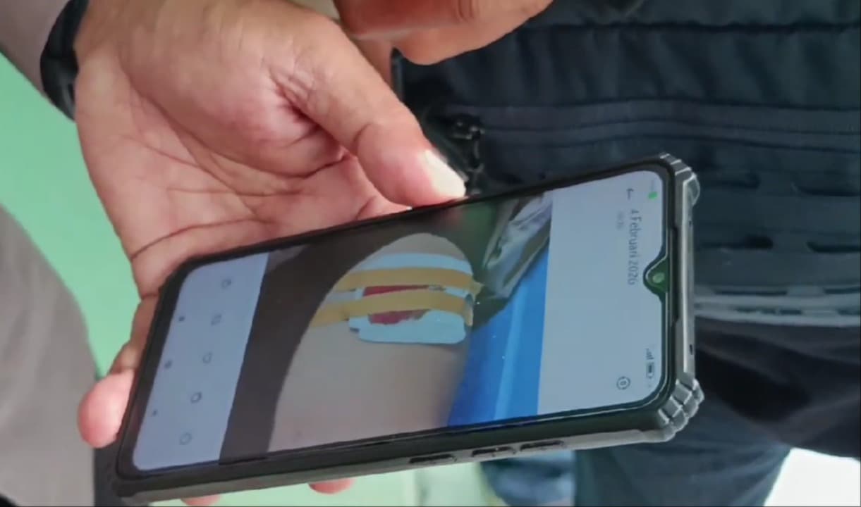 Siswa MTsN 1 Lumajang Terkena Peluru Nyasar saat Istirahat Sekolah