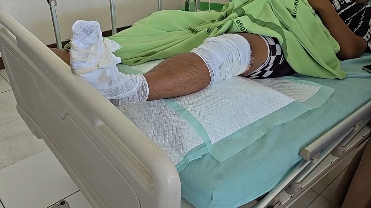 Petugas Damkar Jadi Korban Kebakaran Gudang Oli di Ponorogo, Alami Luka Bakar Serius