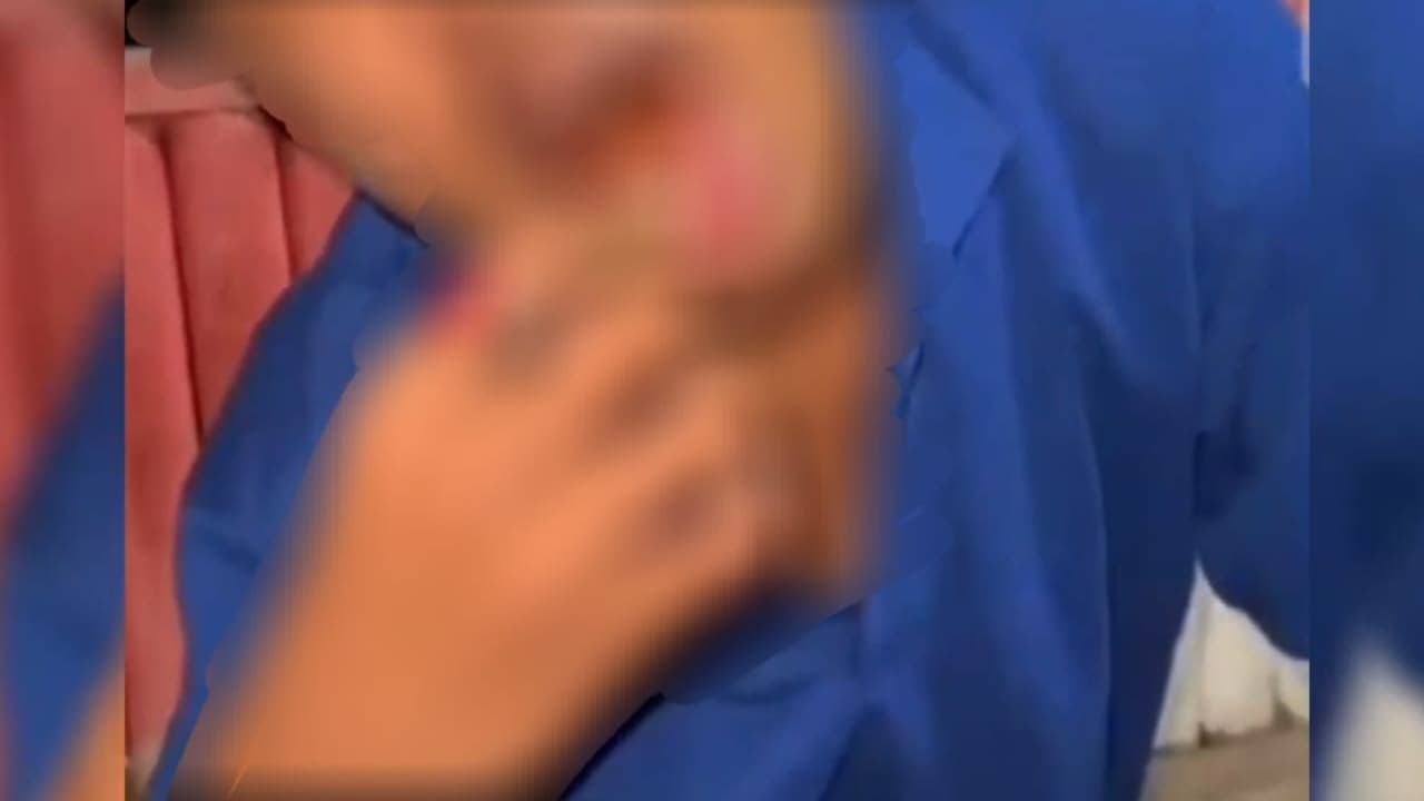 Viral Video Perundungan, Penyandang Disabilitas di Pacitan Dicekoki Miras hingga Dipaksa Makan Genteng
